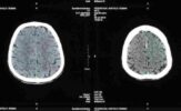 Delving into the Depths of Radiology