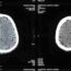 Delving into the Depths of Radiology