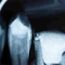 Endodontics_ A Tribute to Their Impact