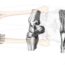 Evolution of Orthopedics_ A Tribute to Pioneers and Contributors