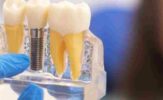 Evolution of Prosthodontics_ A Historical Overview Influential Contributors