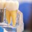 Evolution of Prosthodontics_ A Historical Overview Influential Contributors