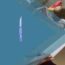 Exploring Surgical Instruments and Devices in Gynecology