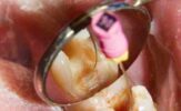 Exploring the Depths_ A Journey into Endodontics