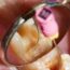 Exploring the Depths_ A Journey into Endodontics