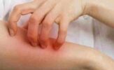 Exploring the Origin and Types of Dermatology_ A Comprehensive Overview