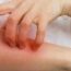 Exploring the Origin and Types of Dermatology_ A Comprehensive Overview