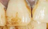 Influential Contributors in Periodontics