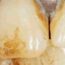 Influential Contributors in Periodontics