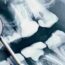 Key Contributors in Oral and Maxillofacial Radiology