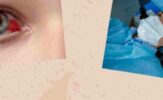 Ophthalmology_ From Ancient Discoveries to Modern Innovations