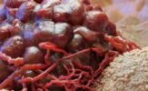 Oral Pathology_ A Decade of Advancements