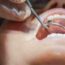 Oral and Maxillofacial Surgery_ Origins, Types, and Major Disorders