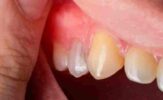 The Roots of Periodontics_ Types and Major Disorders Explored