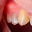 The Roots of Periodontics_ Types and Major Disorders Explored