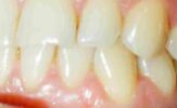 Unveiling the Origin, Types, and Major Disorders of Oral Pathology
