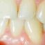 Unveiling the Origin, Types, and Major Disorders of Oral Pathology
